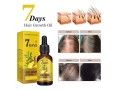 7-days-eelhoe-germinal-oil-fast-hair-growth-nourishment-small-3