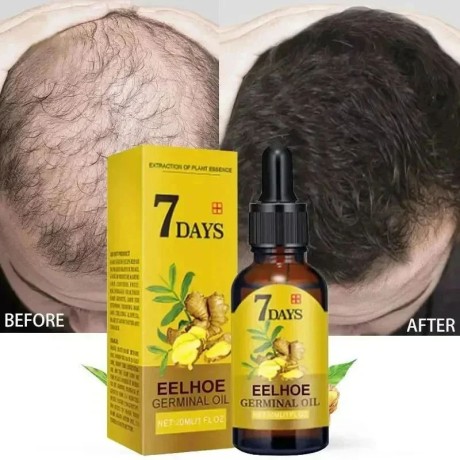 7-days-eelhoe-germinal-oil-fast-hair-growth-nourishment-big-2