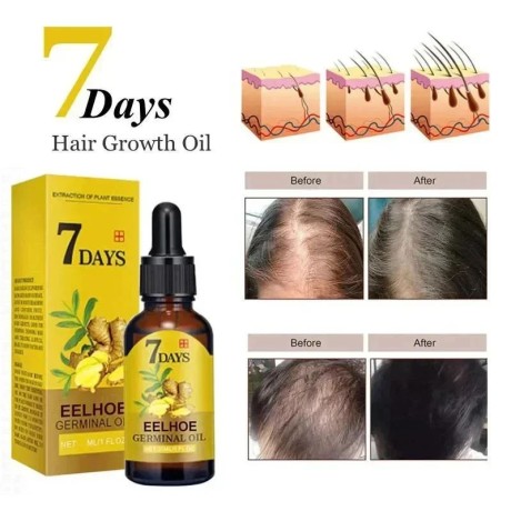 7-days-eelhoe-germinal-oil-fast-hair-growth-nourishment-big-3