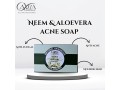 neem-aloevera-acne-soap-small-0